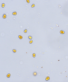 放出された褐虫藻
